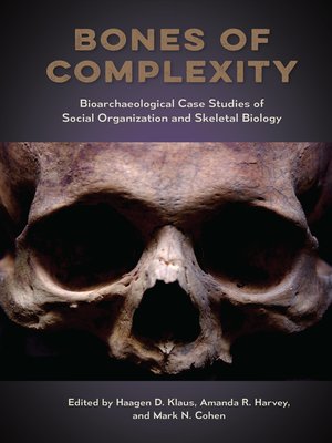 cover image of Bones of Complexity